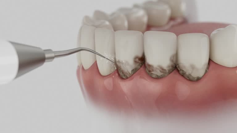 Reliable Teeth Cleaning And Checkup contractor in Prince George's County County, MD by Dentist Open Now